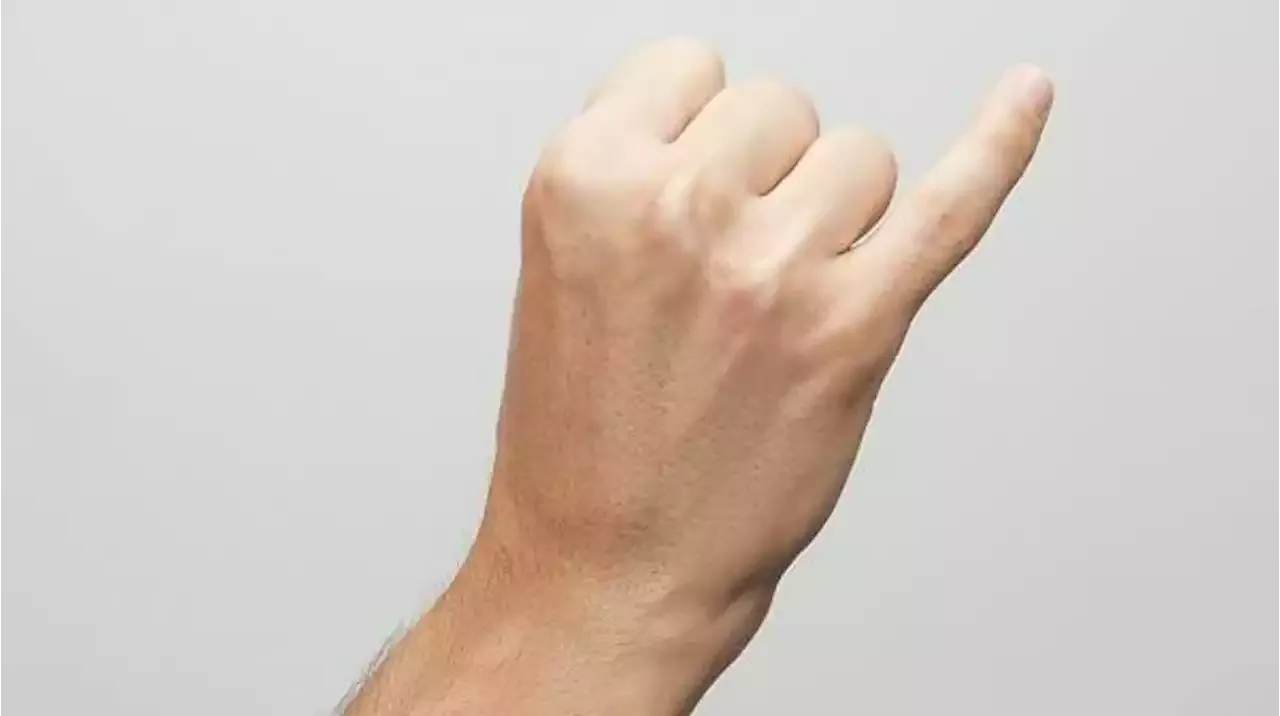 Perder el dedo meñique equivale a perder el 50% de fuerza en el brazo